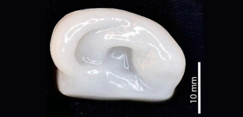 Cartilagem impressa em 3D pode ajudar na reconstrução de membros do corpo